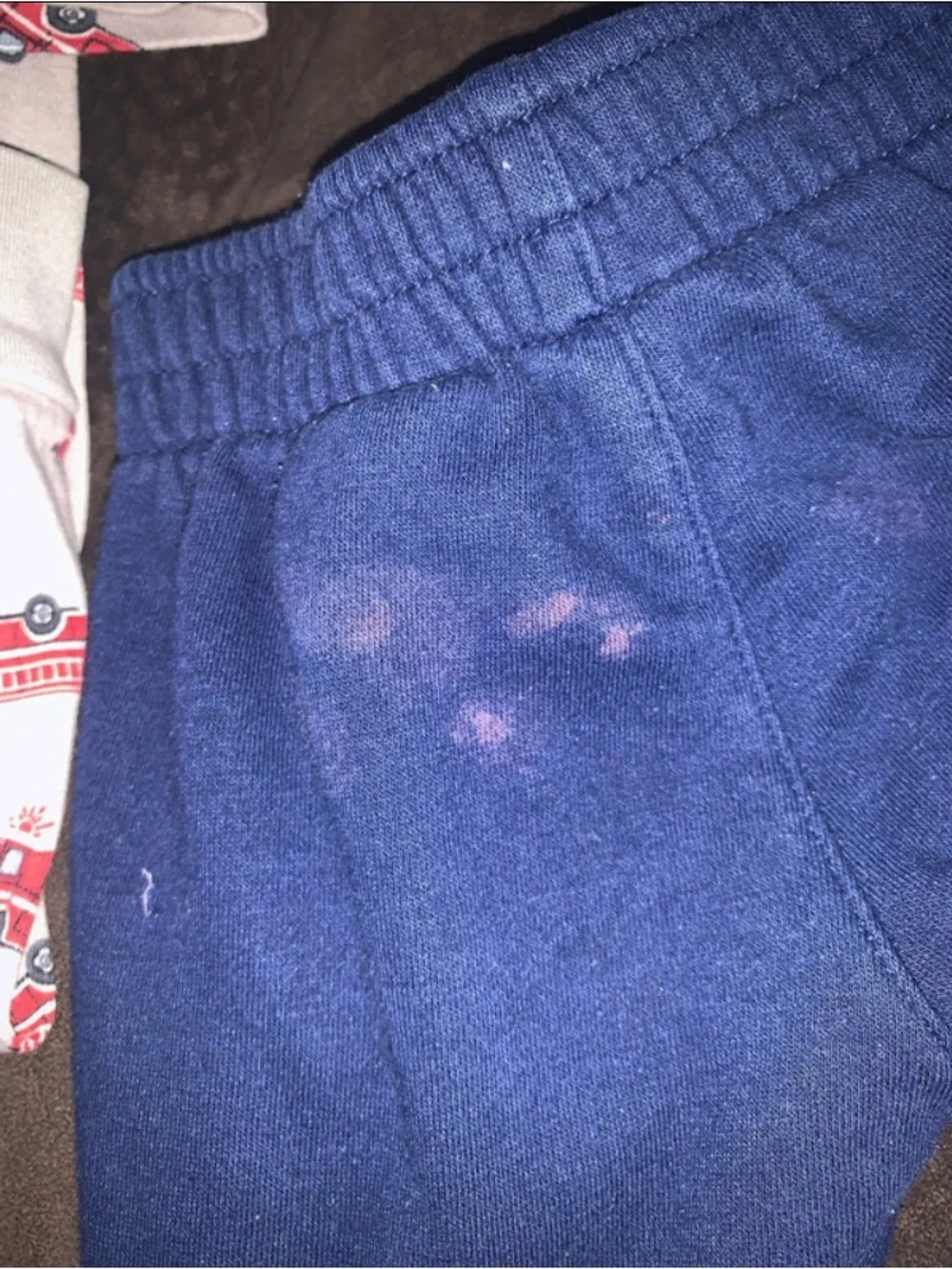 (14) 3T Bundle